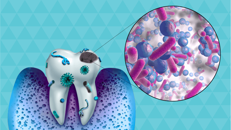 Desequilibrio del microbioma oral puede desembocar en patologías como la diabetes